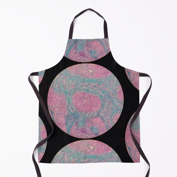Item preview, Histology of liver cirrhosis, nodule, human tissue, Masson's trichrome, 40x designed and sold by Psymier.