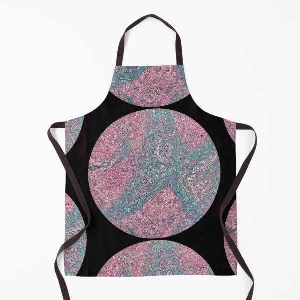 Item preview, Histology of liver cirrhosis, nodule, human tissue, Masson's trichrome, 100x designed and sold by Psymier.