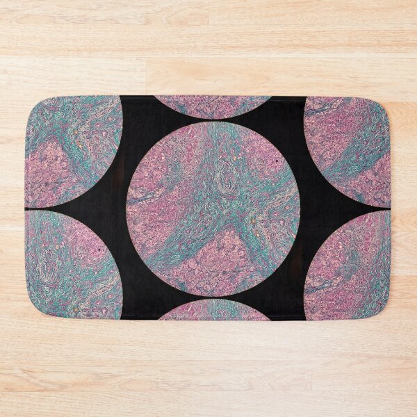 Item preview, Histology of liver cirrhosis, nodule, human tissue, Masson's trichrome, 100x designed and sold by Psymier.