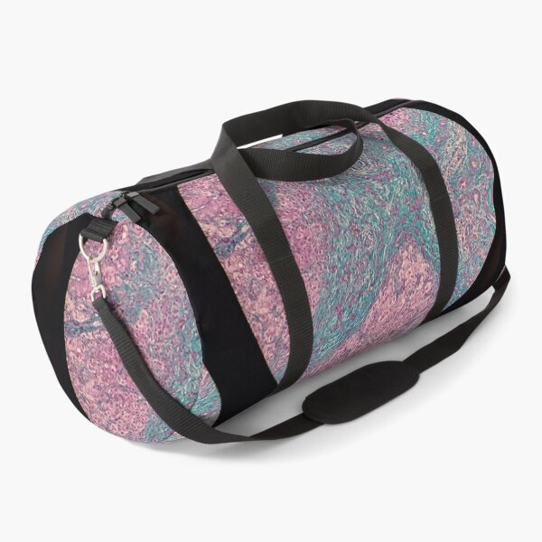 Item preview, Histology of liver cirrhosis, nodule, human tissue, Masson's trichrome, 100x designed and sold by Psymier.