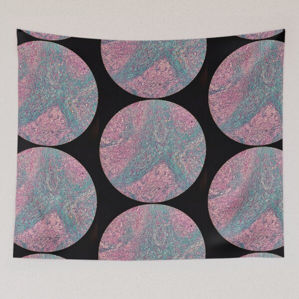 Item preview, Histology of liver cirrhosis, nodule, human tissue, Masson's trichrome, 100x designed and sold by Psymier.
