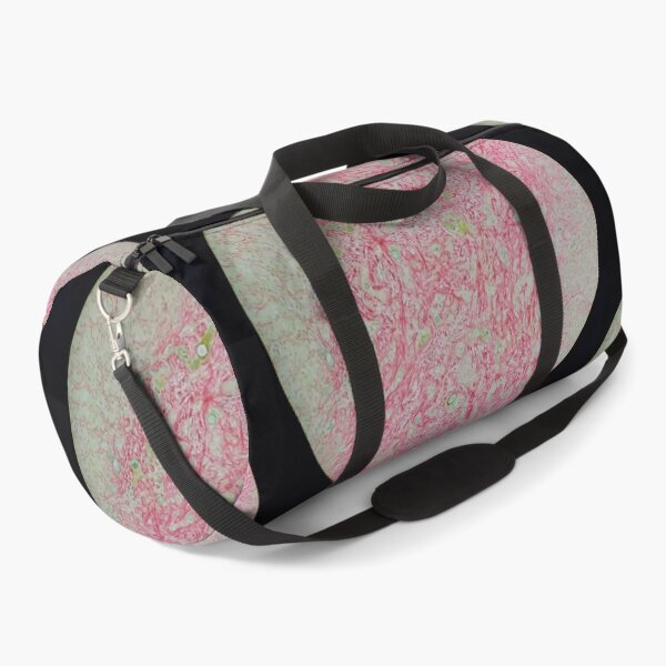 Item preview, Histology of liver cirrhosis, nodule, human tissue, Sirius red, 100x designed and sold by Psymier.