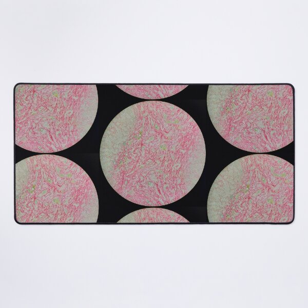 Item preview, Histology of liver cirrhosis, nodule, human tissue, Sirius red, 100x designed and sold by Psymier.