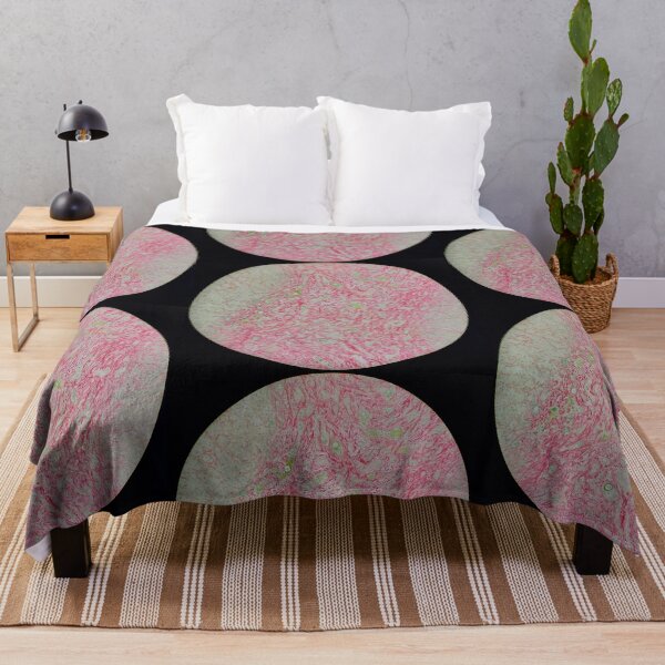 Item preview, Histology of liver cirrhosis, nodule, human tissue, Sirius red, 100x designed and sold by Psymier.