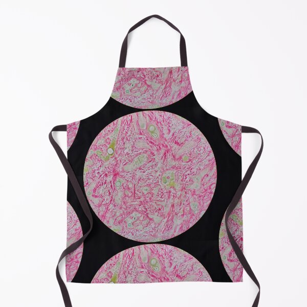 Item preview, Histology of liver cirrhosis, nodule, human tissue, Sirius red, 200x designed and sold by Psymier.