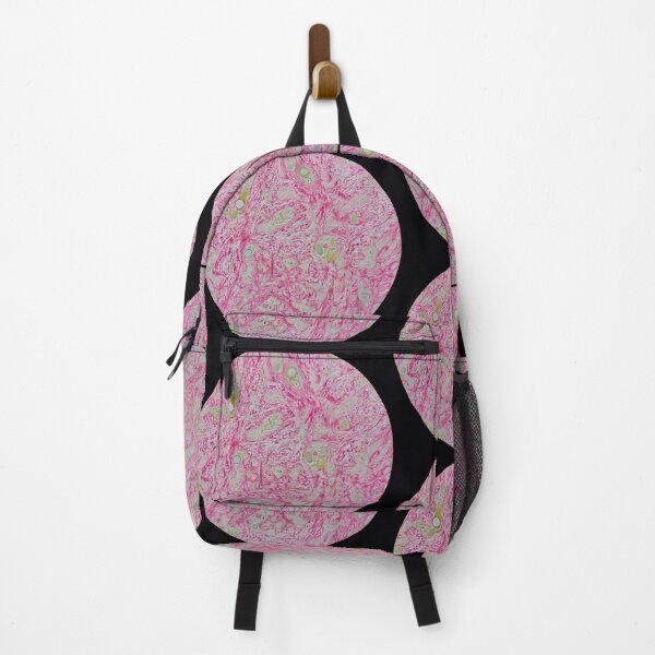Item preview, Histology of liver cirrhosis, nodule, human tissue, Sirius red, 200x designed and sold by Psymier.