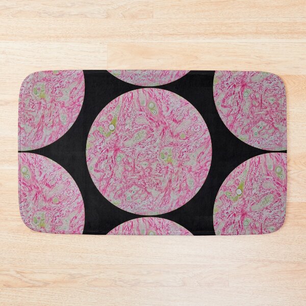 Item preview, Histology of liver cirrhosis, nodule, human tissue, Sirius red, 200x designed and sold by Psymier.