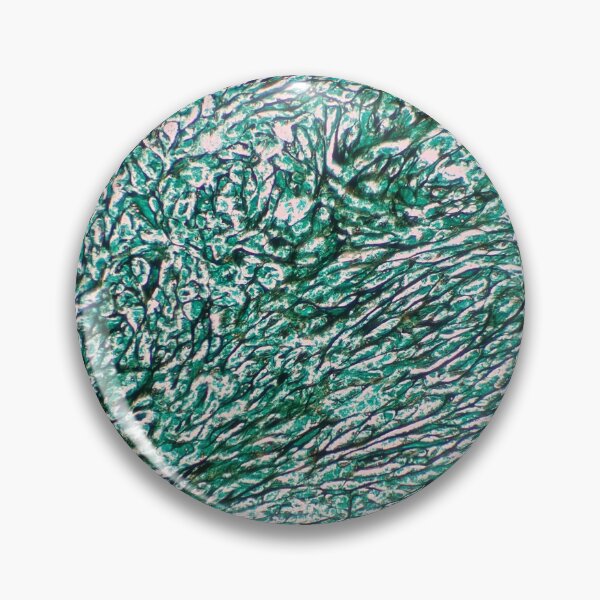 Item preview, Histology of fibrous connective tissue, small intestine, human tissue, Grocott green, 20x designed and sold by Psymier.