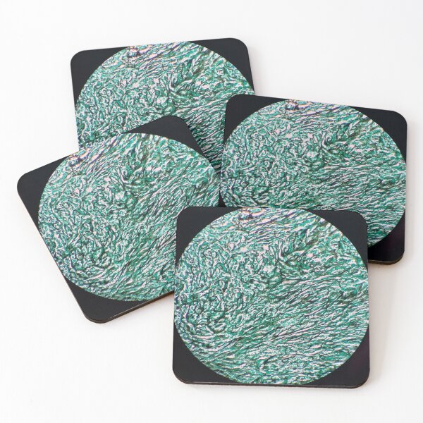 Item preview, Histology of fibrous connective tissue, small intestine, human tissue, Grocott green, 20x designed and sold by Psymier.