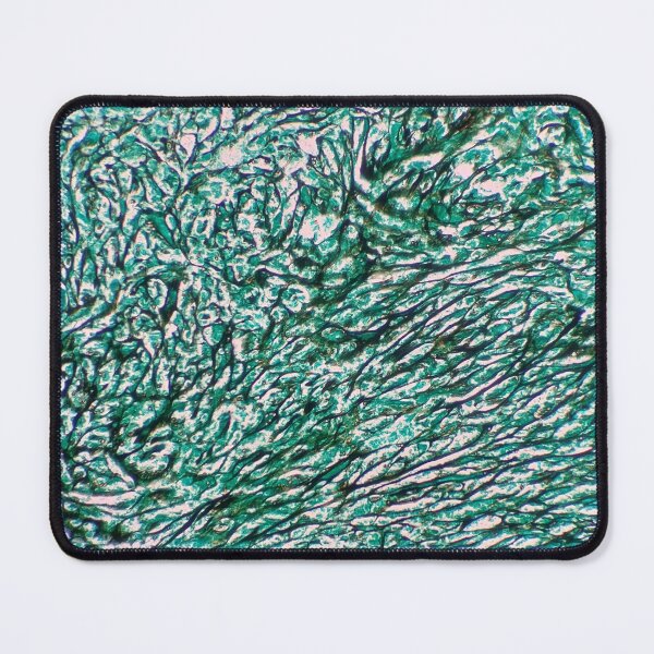 Item preview, Histology of fibrous connective tissue, small intestine, human tissue, Grocott green, 20x designed and sold by Psymier.