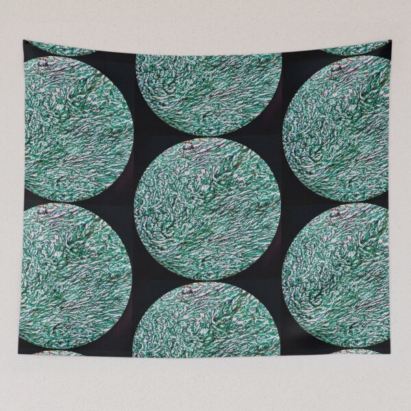 Item preview, Histology of fibrous connective tissue, small intestine, human tissue, Grocott green, 20x designed and sold by Psymier.