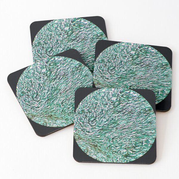 Item preview, Histology of fibrous connective tissue, human tissue, Grocott green, 20x designed and sold by Psymier.