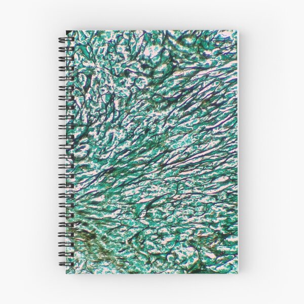 Item preview, Histology of fibrous connective tissue, human tissue, Grocott green, 20x designed and sold by Psymier.