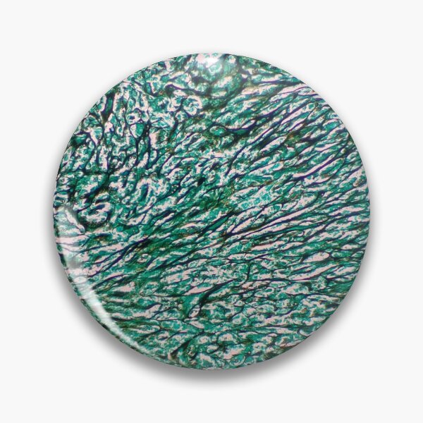 Item preview, Histology of fibrous connective tissue, human tissue, Grocott green, 20x designed and sold by Psymier.