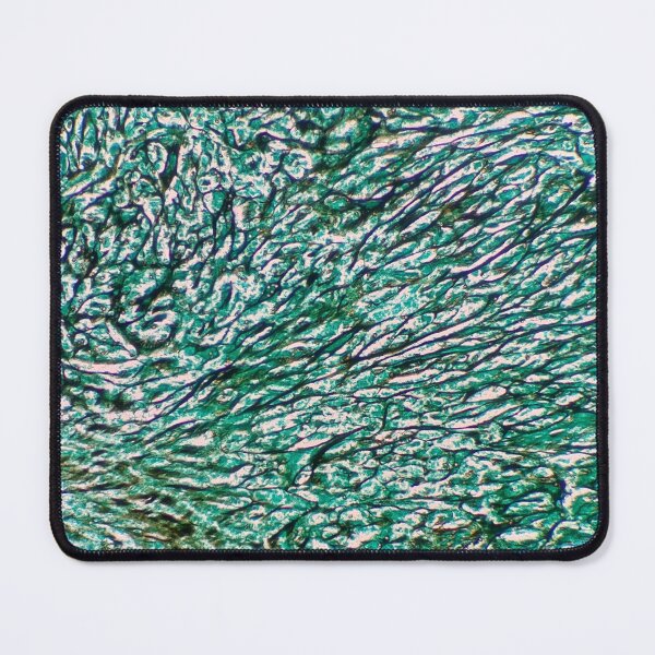 Item preview, Histology of fibrous connective tissue, human tissue, Grocott green, 20x designed and sold by Psymier.