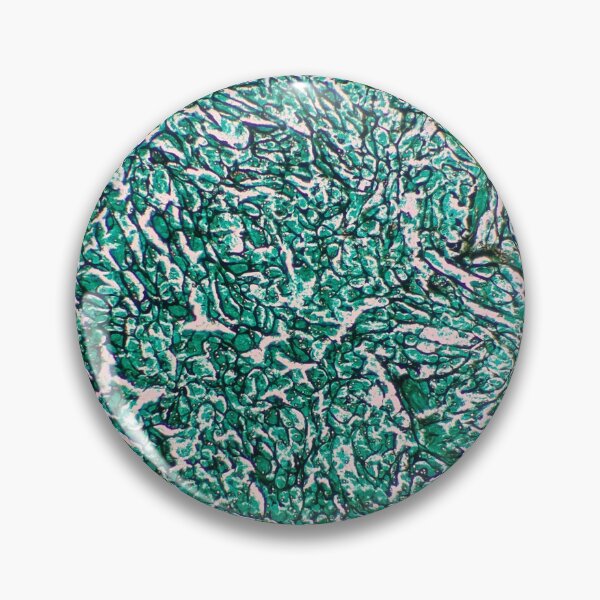 Item preview, Histology of fibrous connective tissue, smooth muscle, human tissue, Grocott green, 20x designed and sold by Psymier.