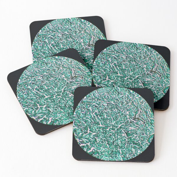 Item preview, Histology of fibrous connective tissue, smooth muscle, human tissue, Grocott green, 20x designed and sold by Psymier.