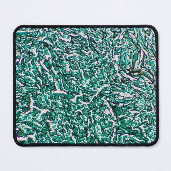 Item preview, Histology of fibrous connective tissue, smooth muscle, human tissue, Grocott green, 20x designed and sold by Psymier.