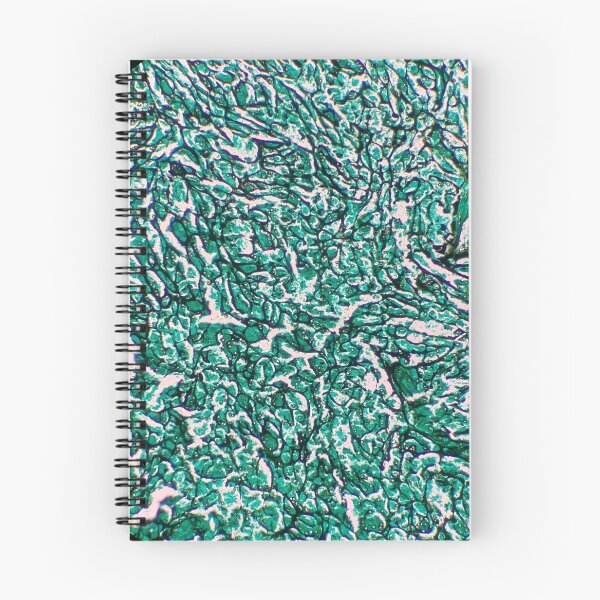 Item preview, Histology of fibrous connective tissue, smooth muscle, human tissue, Grocott green, 20x designed and sold by Psymier.