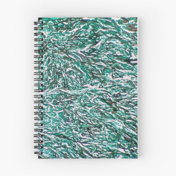 Item preview, Histology of fibrous connective tissue, smooth muscle, human tissue, Grocott green, 40x designed and sold by Psymier.