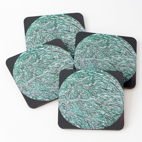 Item preview, Histology of fibrous connective tissue, smooth muscle, human tissue, Grocott green, 40x designed and sold by Psymier.