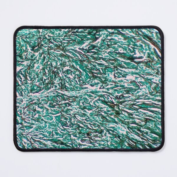 Item preview, Histology of fibrous connective tissue, smooth muscle, human tissue, Grocott green, 40x designed and sold by Psymier.