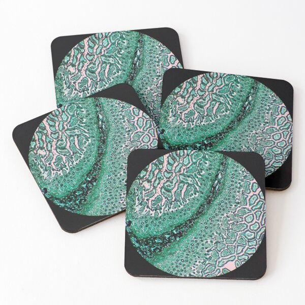 Item preview, Histology of small bowel, intestine, human tissue, Grocott green, 20x designed and sold by Psymier.
