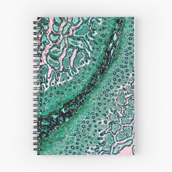 Item preview, Histology of small bowel, intestine, human tissue, Grocott green, 20x designed and sold by Psymier.