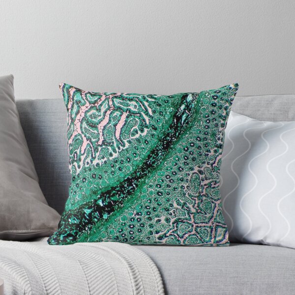 Item preview, Histology of small bowel, intestine, human tissue, Grocott green, 20x designed and sold by Psymier.