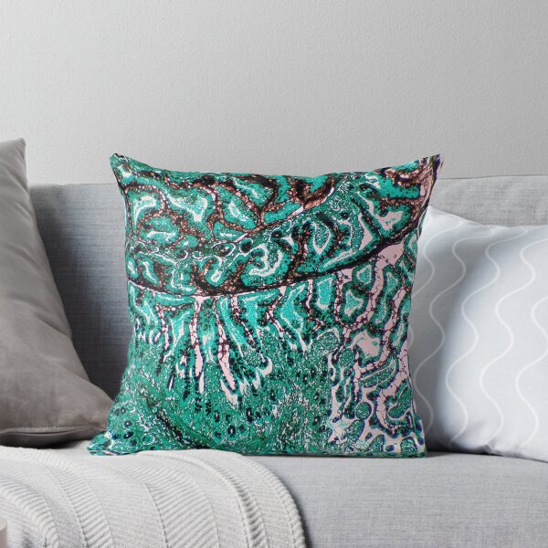 Item preview, Histology of small bowel, intestine, goblet cells, human tissue, Grocott green, 20x designed and sold by Psymier.