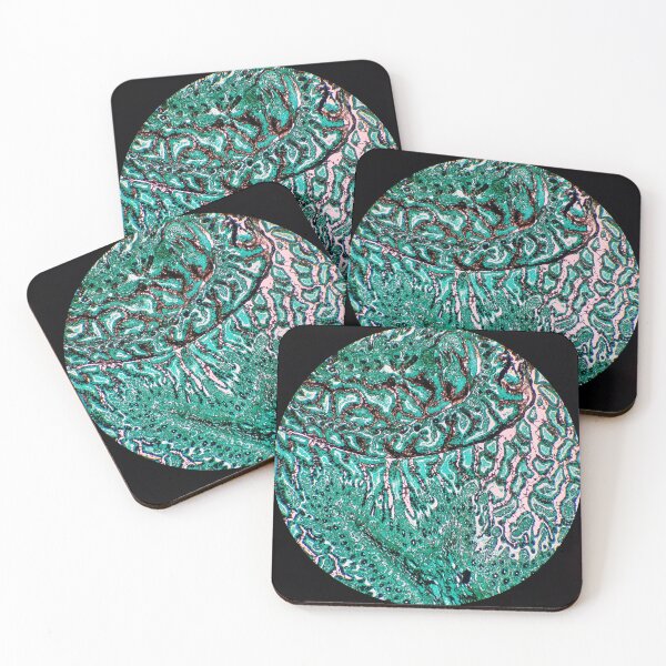 Item preview, Histology of small bowel, intestine, goblet cells, human tissue, Grocott green, 20x designed and sold by Psymier.