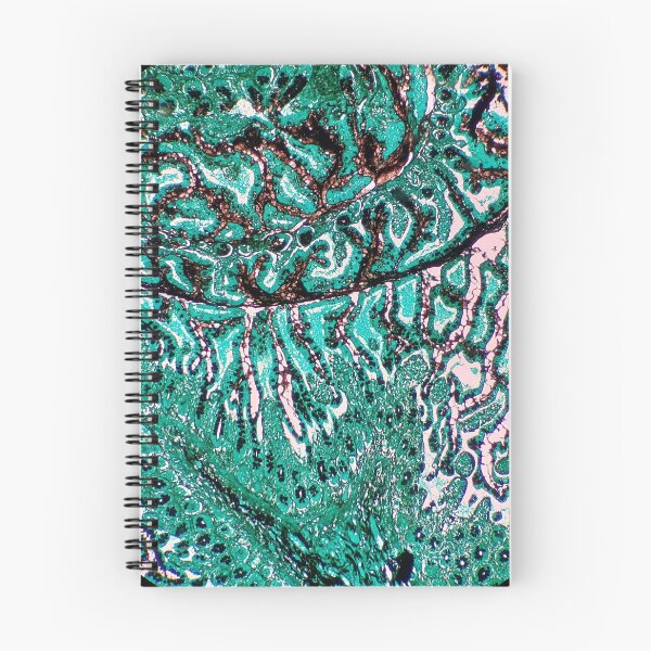 Item preview, Histology of small bowel, intestine, goblet cells, human tissue, Grocott green, 20x designed and sold by Psymier.