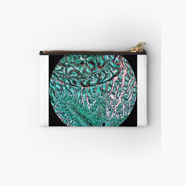 Item preview, Histology of small bowel, intestine, goblet cells, human tissue, Grocott green, 20x designed and sold by Psymier.