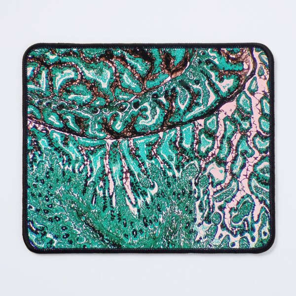 Item preview, Histology of small bowel, intestine, goblet cells, human tissue, Grocott green, 20x designed and sold by Psymier.