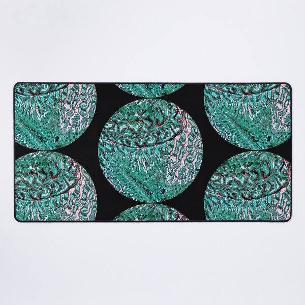 Item preview, Histology of small bowel, intestine, goblet cells, human tissue, Grocott green, 20x designed and sold by Psymier.