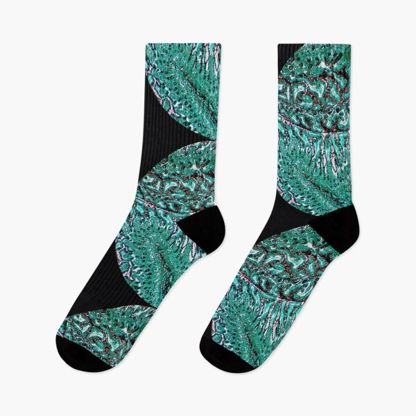 Item preview, Histology of small bowel, intestine, goblet cells, human tissue, Grocott green, 20x designed and sold by Psymier.