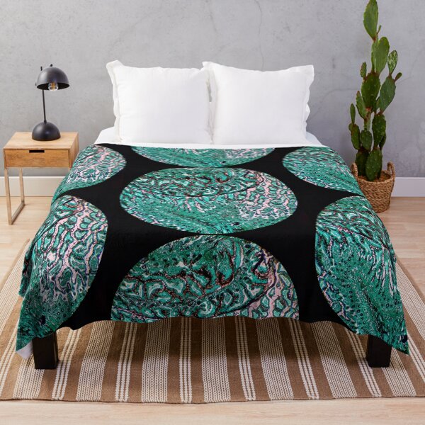 Item preview, Histology of small bowel, intestine, goblet cells, human tissue, Grocott green, 20x designed and sold by Psymier.