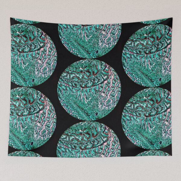 Item preview, Histology of small bowel, intestine, goblet cells, human tissue, Grocott green, 20x designed and sold by Psymier.