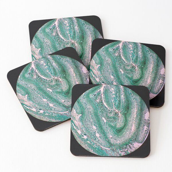 Item preview, Histology of small bowel, intestine, goblet cells, human tissue, Grocott green, low magnification designed and sold by Psymier.