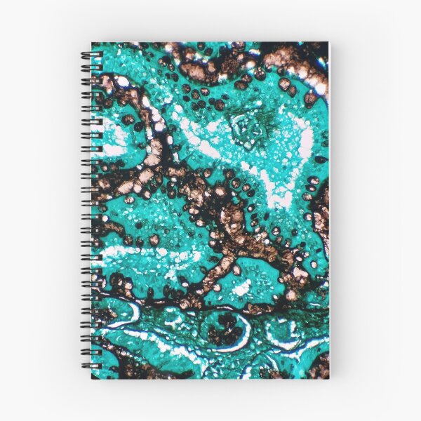 Item preview, Histology of small bowel, intestine, goblet cells, human tissue, Grocott green, 200x designed and sold by Psymier.