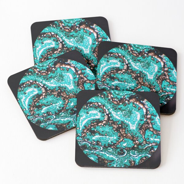 Item preview, Histology of small bowel, intestine, goblet cells, human tissue, Grocott green, 200x designed and sold by Psymier.