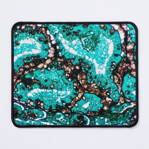 Item preview, Histology of small bowel, intestine, goblet cells, human tissue, Grocott green, 200x designed and sold by Psymier.