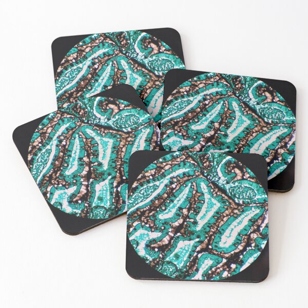 Item preview, Histology of small bowel glands, intestine, goblet cells, human tissue, Grocott green, 200x designed and sold by Psymier.