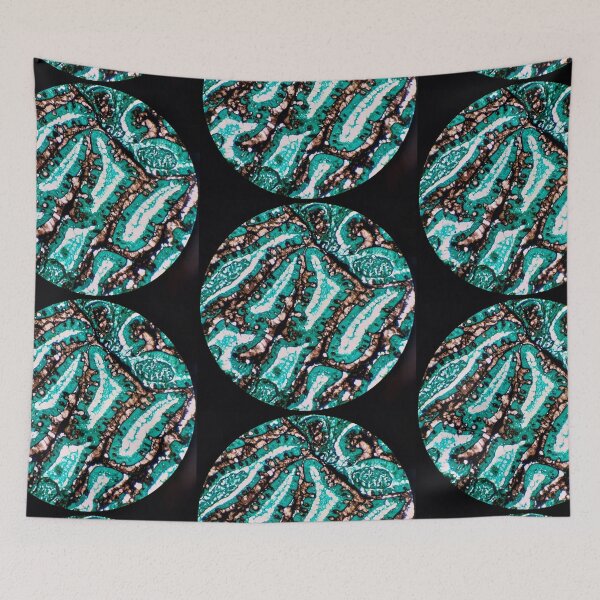 Item preview, Histology of small bowel glands, intestine, goblet cells, human tissue, Grocott green, 200x designed and sold by Psymier.