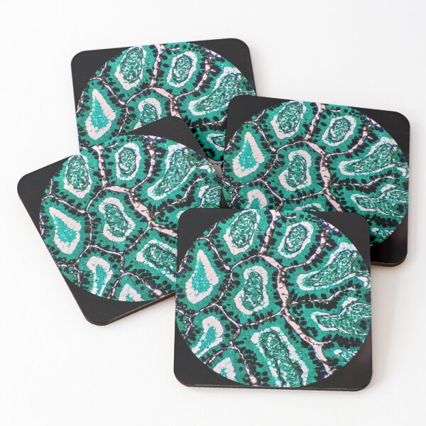 Item preview, Histology of small bowel glands and villi, intestine, goblet cells, human tissue, Grocott green, 200x designed and sold by Psymier.