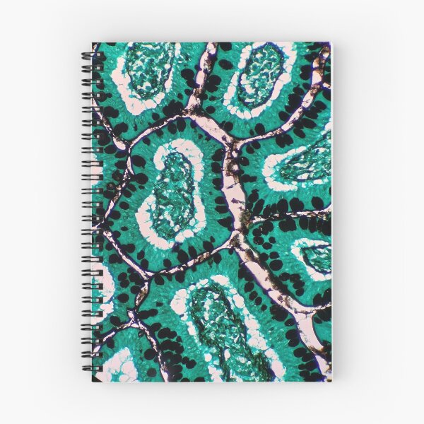 Item preview, Histology of small bowel glands and villi, intestine, goblet cells, human tissue, Grocott green, 200x designed and sold by Psymier.