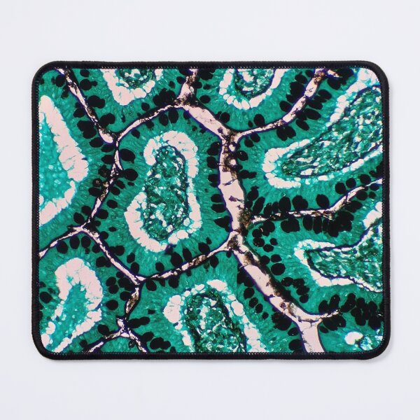 Item preview, Histology of small bowel glands and villi, intestine, goblet cells, human tissue, Grocott green, 200x designed and sold by Psymier.