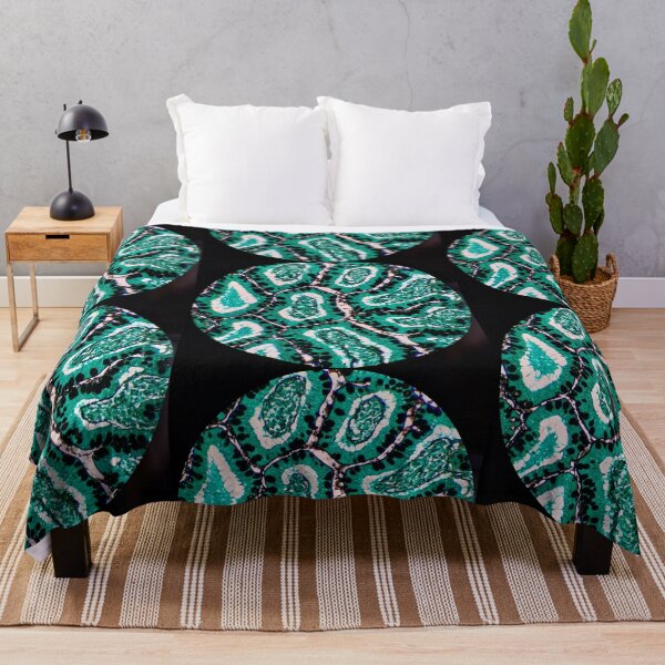 Item preview, Histology of small bowel glands and villi, intestine, goblet cells, human tissue, Grocott green, 200x designed and sold by Psymier.