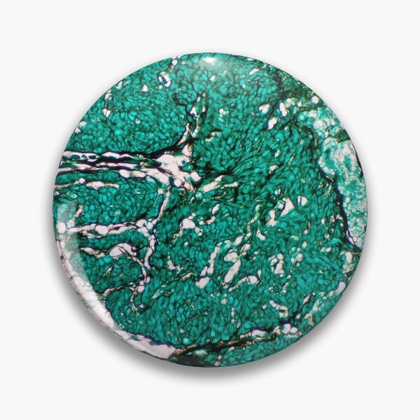 Item preview, Histology of fibroadipose, human tissue, Grocott green, 20x designed and sold by Psymier.