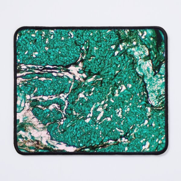 Item preview, Histology of fibroadipose, human tissue, Grocott green, 20x designed and sold by Psymier.